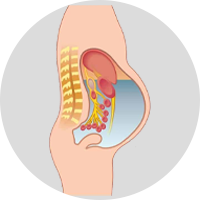 ascites-ayurvedic-treatment