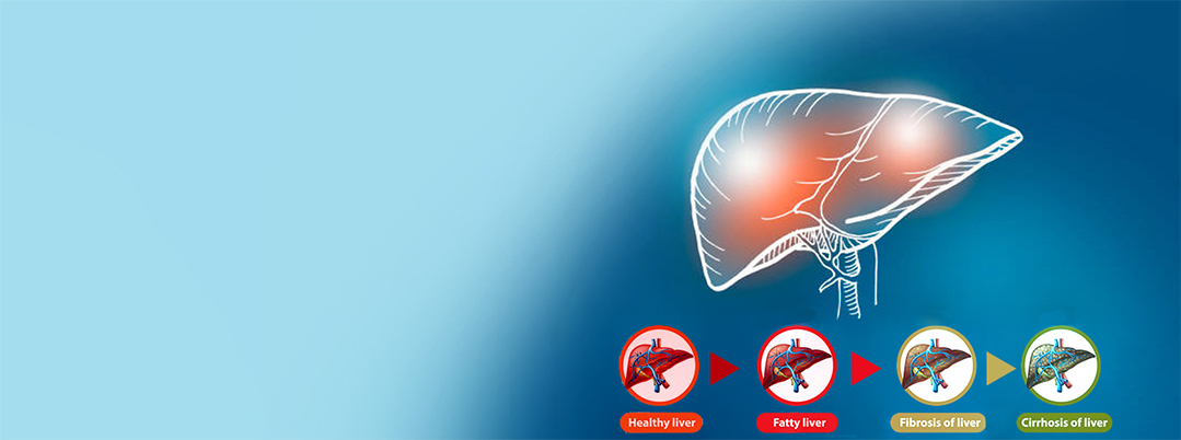 ayurvedic-treatment-of-liver