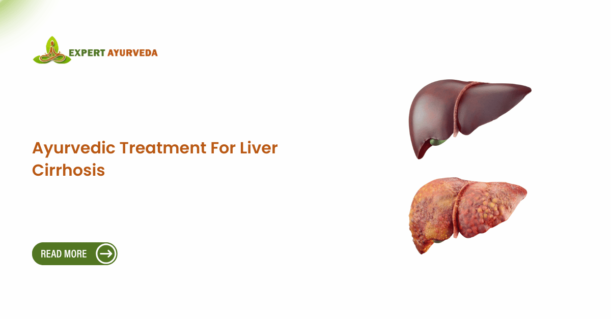 Ayurvedic Treatment For Liver Cirrhosis