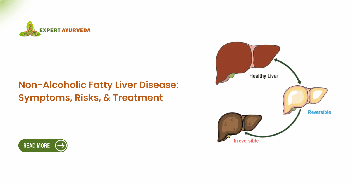 Non-Alcoholic Fatty Liver Disease: Symptoms, Risks, & Treatment