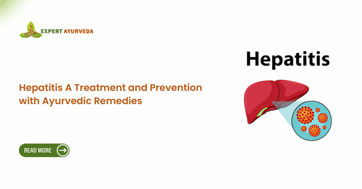 Hepatitis A Treatment and Prevention with Ayurvedic Remedies