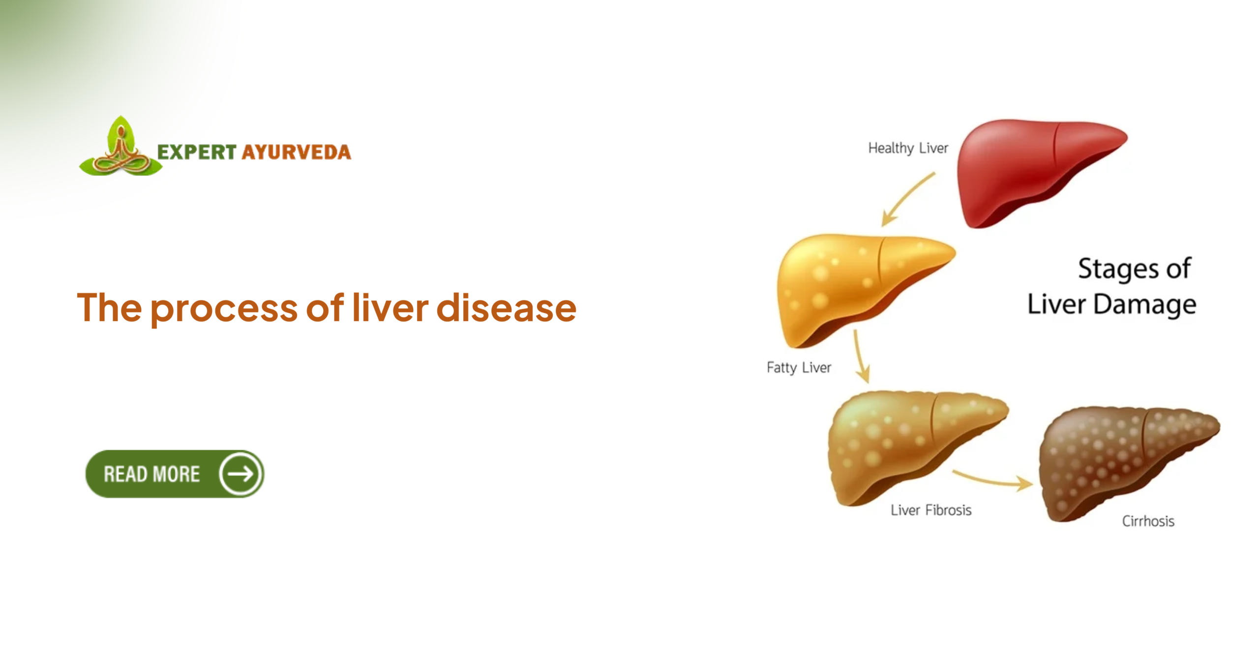 Causes of Liver Damage
